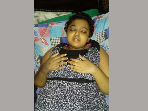 Cancer patient Sai Sri dies, Family protest at MLA's residence Cancer patient Sai Sri dies, Family protest at MLA's residence