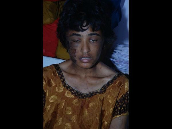 సవతి తల్లి చేతిలో చిత్రహింసలు
