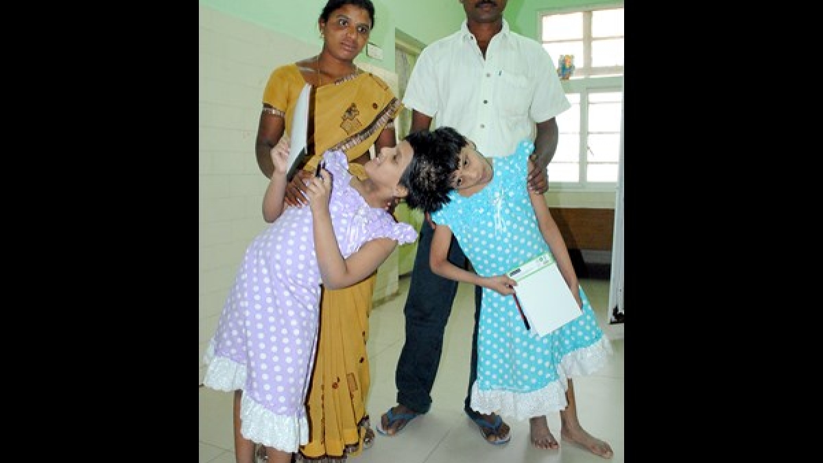 అదే మా కోరిక 15వ పుట్టిన రోజు జరుపుకున్న వీణావాణీ Telangana's