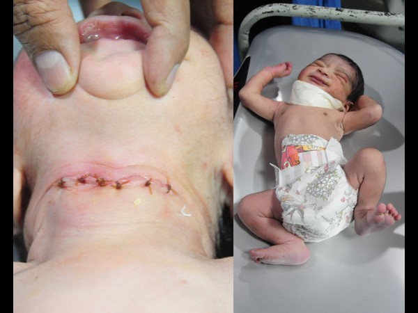 A man allegedly Cut off a infant's throat in Hanamkonda A man allegedly Cut off a infant's throat in Hanamkonda