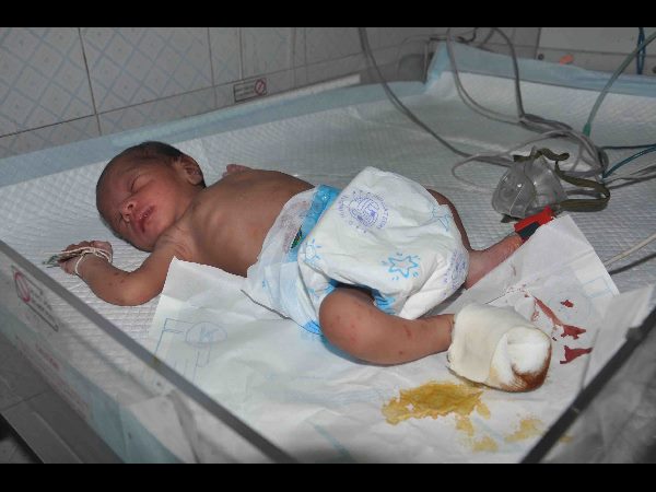 A infant hospitalized in Visakhapatnam A infant hospitalized in Visakhapatnam