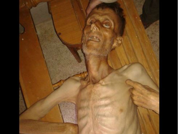 Syrian crisis: People survive on cats and grass, says Report Syrian crisis: People survive on cats and grass, says Report