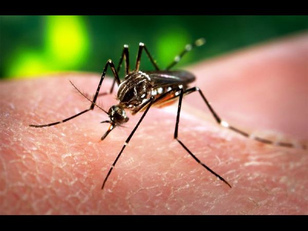 The rare birth defect that's triggering panic over the Zika virus The rare birth defect that's triggering panic over the Zika virus