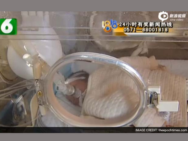 'Dead' Chinese Baby Wakes Up Just Before Cremation 'Dead' Chinese Baby Wakes Up Just Before Cremation