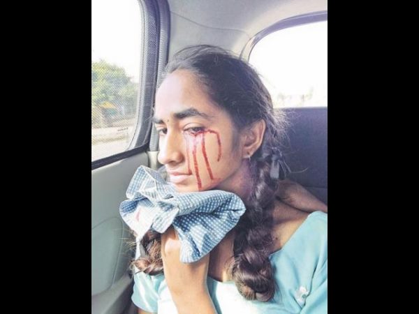 The girl who bleeds from her eyes in east godavari The girl who bleeds from her eyes in east godavari