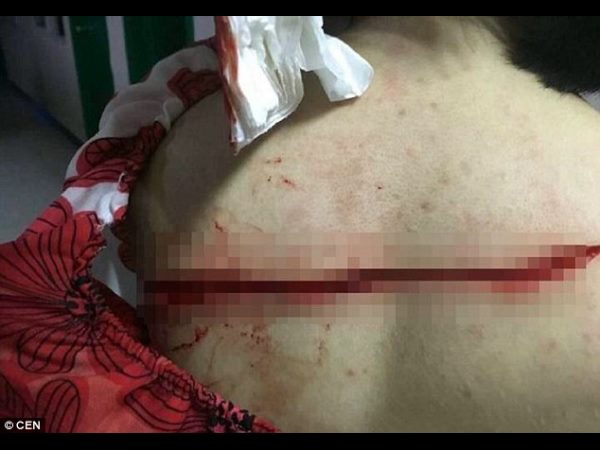 Bored man ‘deliberately slashes woman’s back because he was looking for a THRILL’ Bored man ‘deliberately slashes woman’s back because he was looking for a THRILL’