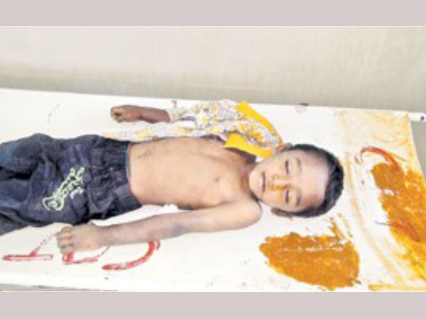 Boy hands cut after he refuses to beg in Kurnool. Boy hands cut after he refuses to beg in Kurnool.