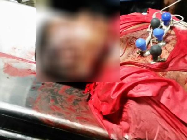 RSS leader Rudresh murder case cracked by Bengaluru police. RSS leader Rudresh murder case cracked by Bengaluru police.