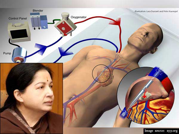 Chennai: Tamil Nadu chief minister who suffered a cardiac arrest Chennai: Tamil Nadu chief minister who suffered a cardiac arrest
