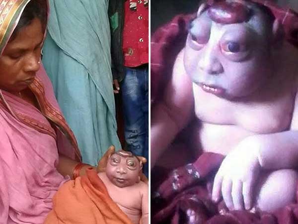 Shocked mum of baby boy born with bulging eyes and shell-like body refused to breastfeed her ‘alien’ son Shocked mum of baby boy born with bulging eyes and shell-like body refused to breastfeed her ‘alien’ son