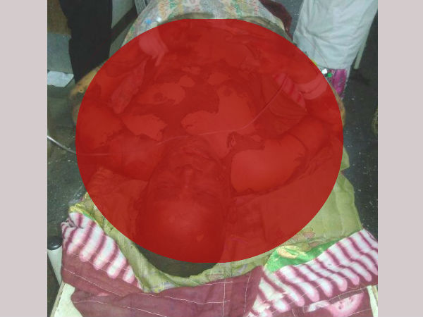 Couple torched and killed in Medak district Couple torched and killed in Medak district