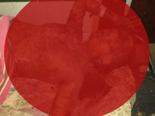 Couple torched and killed in Medak district Couple torched and killed in Medak district