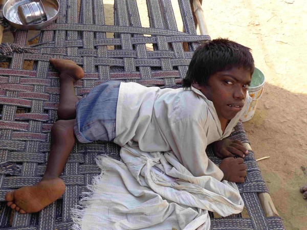 ఇంటికొక ఫ్లోరైడ్ బాధితులు