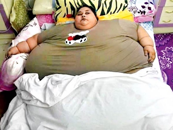 Eman Ahmed, Once World's Heaviest Woman, Dies In Abu Dhabi Eman Ahmed, Once World's Heaviest Woman, Dies In Abu Dhabi