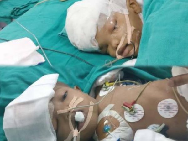 చాలా అరుదు..