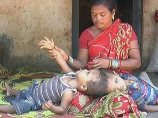 ఒక రోజుపాటు శస్త్రచికిత్స