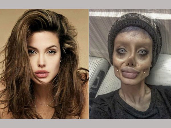 bizarre: 19-year-old got 50 surgeries to look like Angelina Jolie. Now trolls are calling her zombie bizarre: 19-year-old got 50 surgeries to look like Angelina Jolie. Now trolls are calling her zombie