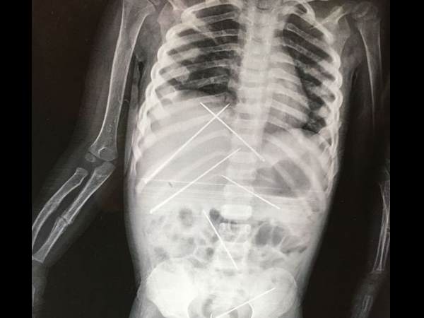 Woman Climbs Into X-Ray Machine At Train Station For This Bizarre Reason Woman Climbs Into X-Ray Machine At Train Station For This Bizarre Reason