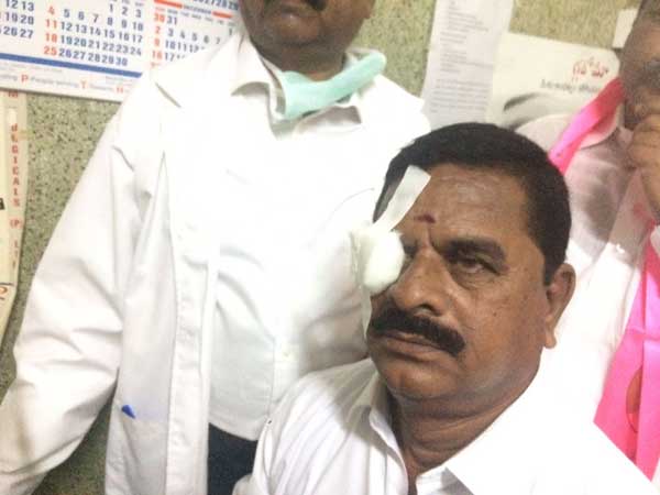 Cong MLA flings headphone in Telangana Assembly, injures council head’s eye Cong MLA flings headphone in Telangana Assembly, injures council head’s eye