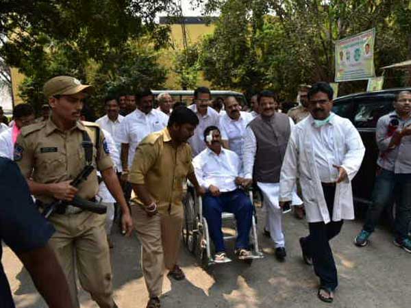 కుడి కంటికి దెబ్బ తగిలింది: వైద్యులు