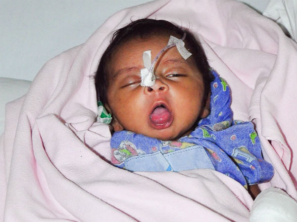 1-month-old daughter of a daily wage worker needs an urgent heart surgery 1-month-old daughter of a daily wage worker needs an urgent heart surgery