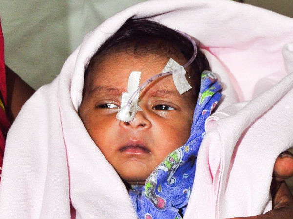 1-month-old daughter of a daily wage worker needs an urgent heart surgery 1-month-old daughter of a daily wage worker needs an urgent heart surgery