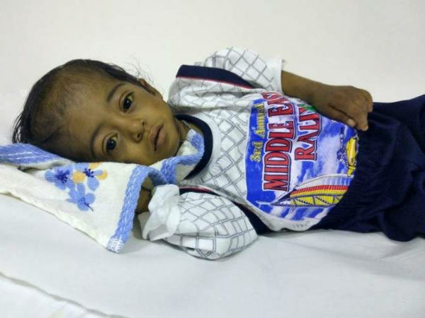 This boy cannt live without surgery This boy cannt live without surgery