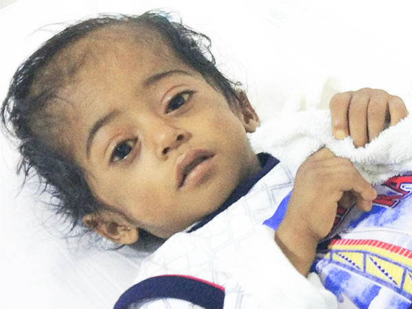 This boy cannt live without surgery This boy cannt live without surgery