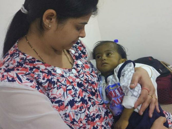 This boy cannt live without surgery This boy cannt live without surgery