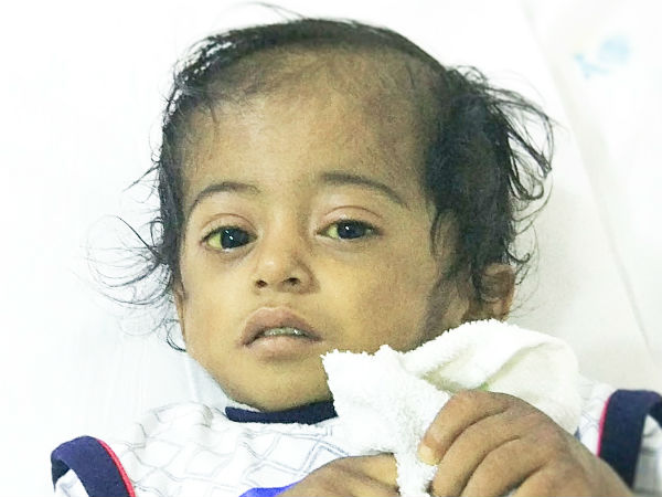 This boy cannt live without surgery This boy cannt live without surgery