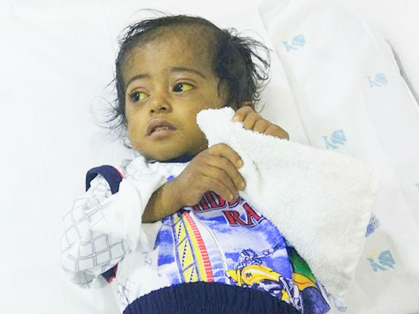 This boy cannt live without surgery This boy cannt live without surgery