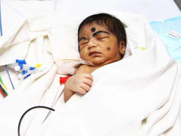 A mother’s struggle to keep her newborn son’s heart beating A mother’s struggle to keep her newborn son’s heart beating