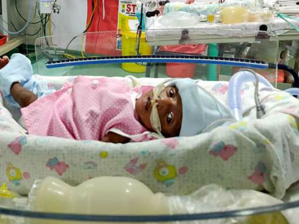KTR responds girl child ventilator problem, already sanctioned Rs. 2 lakhs from CMRF KTR responds girl child ventilator problem, already sanctioned Rs. 2 lakhs from CMRF