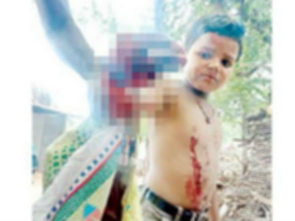 cell phone blasted in a boys hand in kurnool cell phone blasted in a boys hand in kurnool