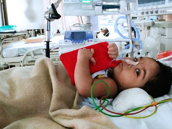 Even after 3 surgeries, this 1-year-old struggles for each breath Even after 3 surgeries, this 1-year-old struggles for each breath