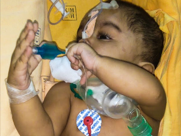 Even after 3 surgeries, this 1-year-old struggles for each breath Even after 3 surgeries, this 1-year-old struggles for each breath