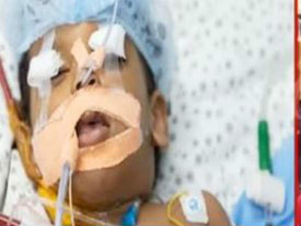 kid Hospitalised for Day Care Center Negligence at Madhura Nagar kid Hospitalised for Day Care Center Negligence at Madhura Nagar