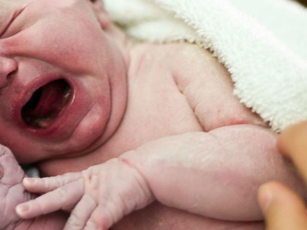 Doctor accidentally cuts off babys head during delivery Doctor accidentally cuts off babys head during delivery