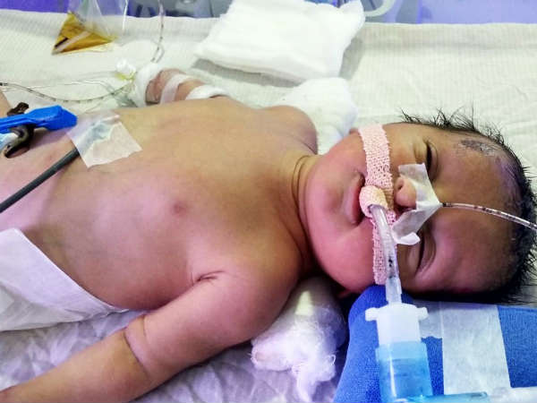 Help baby of Lakshmi, who is unhelathy. Help Lakshmi to save her newborn. Help baby of Lakshmi, who is unhelathy. Help Lakshmi to save her newborn.
