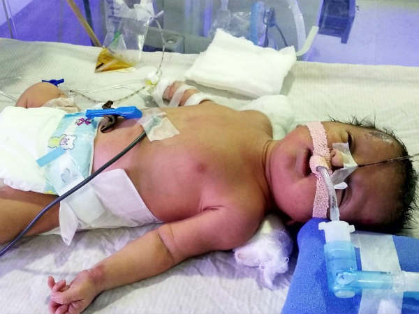 Help baby of Lakshmi, who is unhelathy. Help Lakshmi to save her newborn. Help baby of Lakshmi, who is unhelathy. Help Lakshmi to save her newborn.