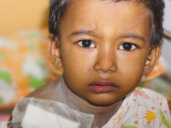 3 year old Avijit Who Suffers From Cancer Will Not Survive Without Urgent Treatment 3 year old Avijit Who Suffers From Cancer Will Not Survive Without Urgent Treatment