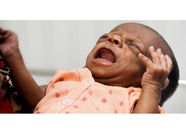 A Month Old Baby Struggles To Breathe Due To Heart Disease A Month Old Baby Struggles To Breathe Due To Heart Disease