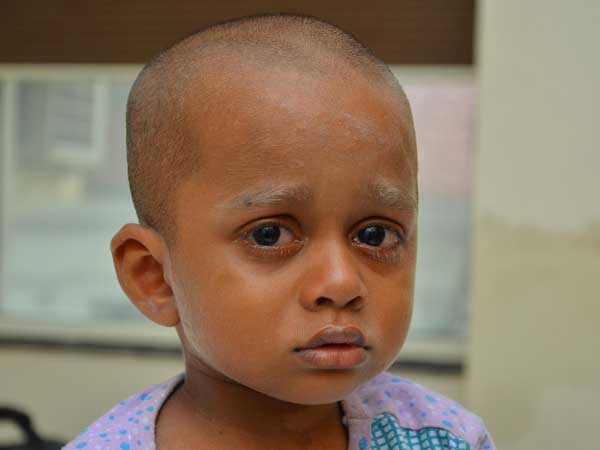 A rare disorder is consuming my son’s life & our income is insufficient to treat him A rare disorder is consuming my son’s life & our income is insufficient to treat him