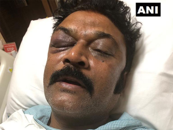 రిసార్టులో రాత్రి డిన్నర్