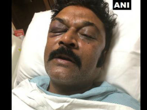 case filed against karnataka congress mla ganesh case filed against karnataka congress mla ganesh