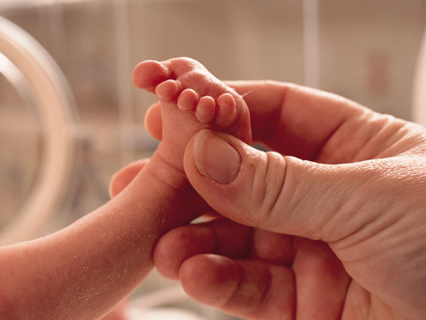 Boy born with 24 fingers and toes..People looking him strangely Boy born with 24 fingers and toes..People looking him strangely