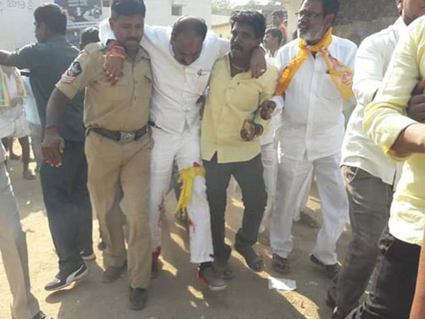 టిడిపి - వైసిపి వర్గాల మధ్య ఘర్షణలో గాయపడ్డ తిక్కారెడ్డి