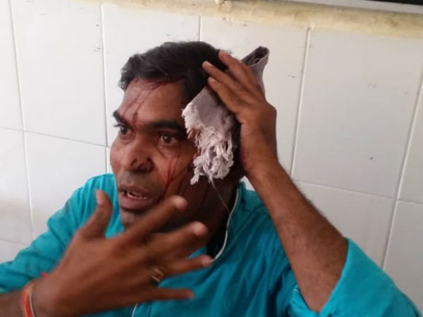 RTC bus accident ,30 passengers wereinjured in Bhupalapalli district RTC bus accident ,30 passengers wereinjured in Bhupalapalli district