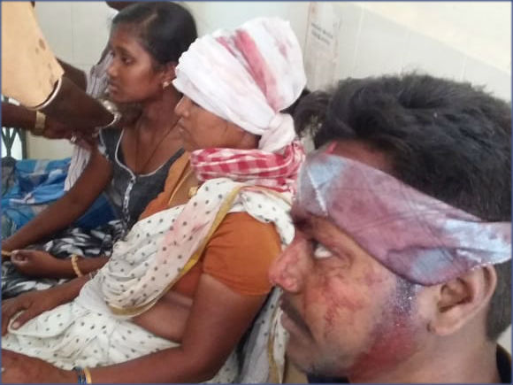 RTC bus accident ,30 passengers wereinjured in Bhupalapalli district RTC bus accident ,30 passengers wereinjured in Bhupalapalli district