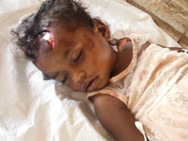 MLA Seethakkas vehicle stumbled a bike a little girl died.. parents injured MLA Seethakkas vehicle stumbled a bike a little girl died.. parents injured